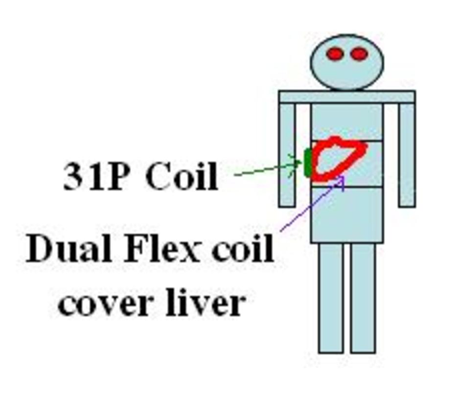 coil