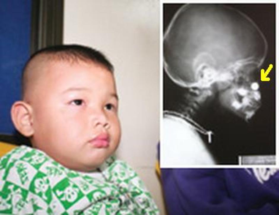 xray_kid