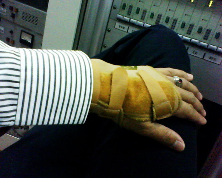เจ็บข้อมือ